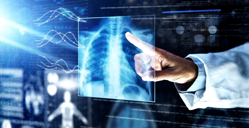 Radiografiile toracice ajută la diagnosticul timpuriu al cancerului pulmonar
