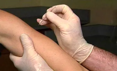 Sistarea vaccinarii anti-variolice a stimulat raspandirea HIV