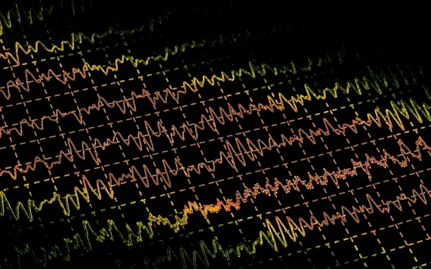 Electroencefalograma (EEG) este utilizată azi pe scară largă pentru confirmarea diagnosticului de epilepsie. 