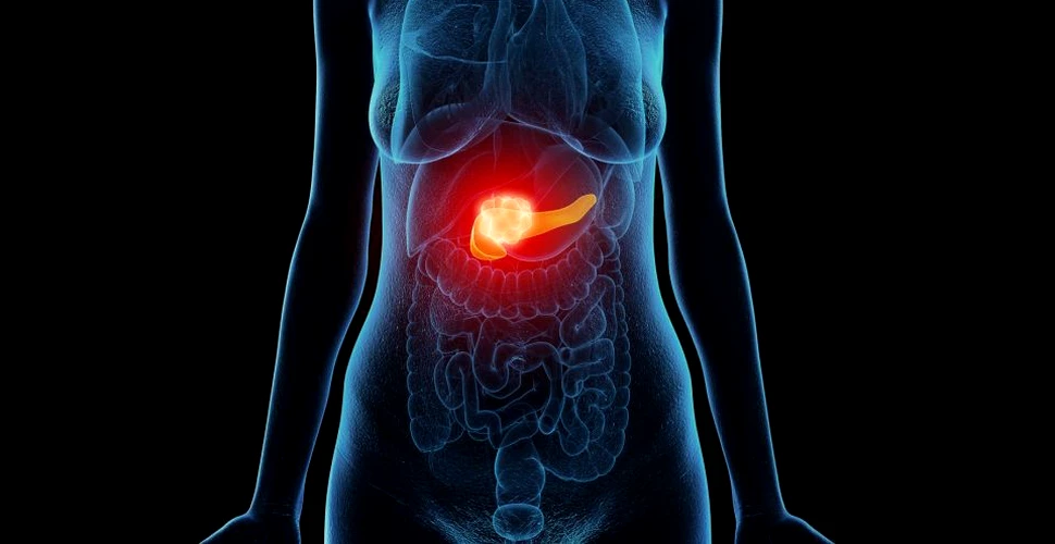 Cercetătorii israelieni au descoperit că un medicament folosit în cancerul ovarian şi mamar este eficient şi în cel de pancreas
