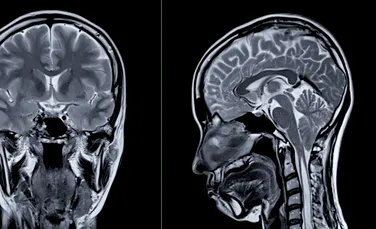 Sfatul neurologului: La ce obiceiuri să renunțăm pentru un creier sănătos?