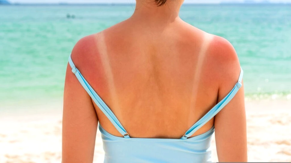 Pielea noastră are o armă secretă împotriva cancerului, însă Soarele o dezactivează