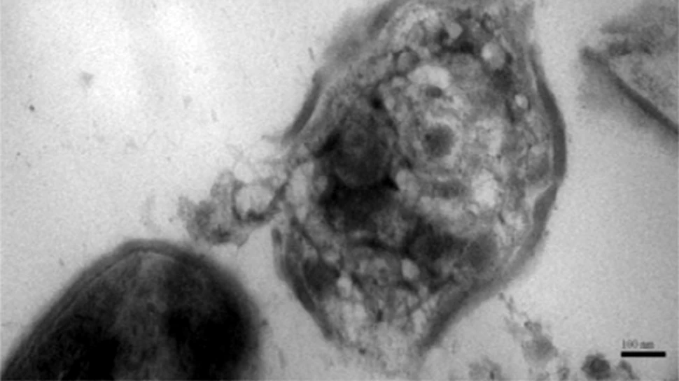 Nanoparticulele, mai tari decât antibioticele în lupta cu bacteriile!