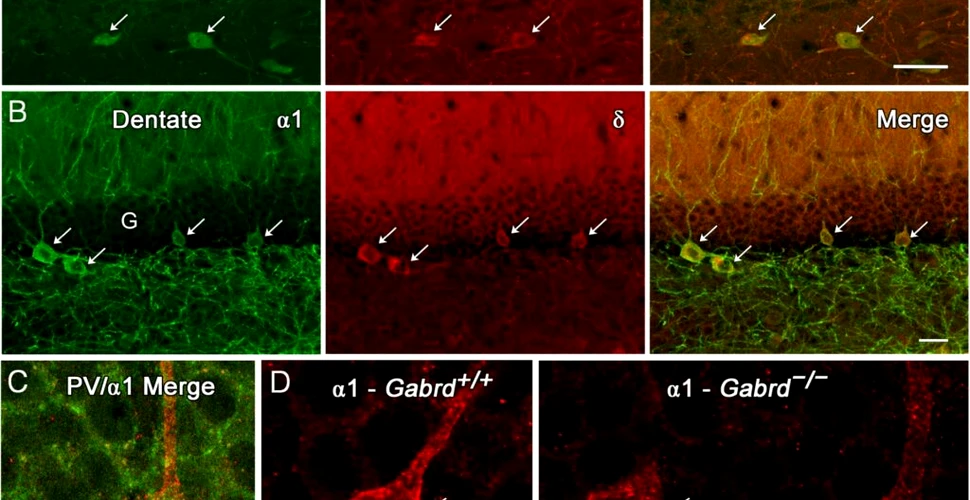 Un medicament a restabilit amintirile pierdute din cauza bolii Alzheimer