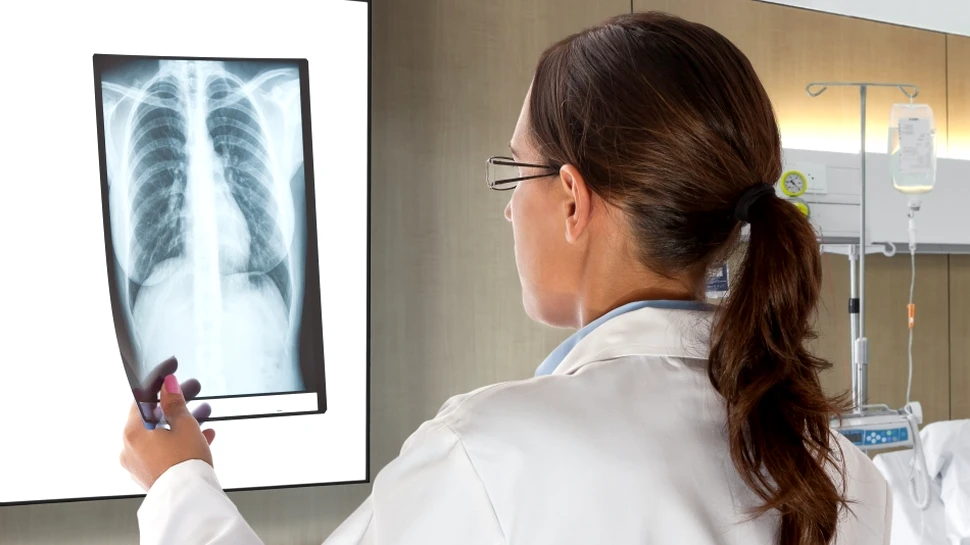 Primul tratament pentru fibroză chistică va fi disponibil în următorii cinci ani