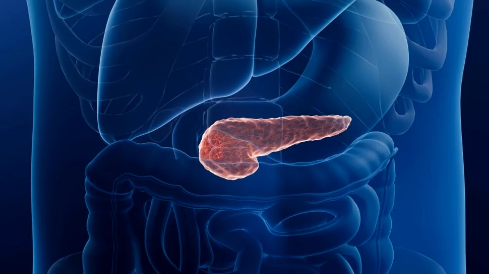 Cancerul pancreatic, depistat înainte să fie vizibil la tomografie. Ce aduce nou inteligența artificială