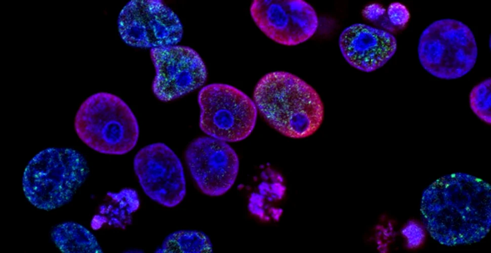 O nouă abordare asupra imunoterapiilor ar putea elimina chiar și tumorile rezistente