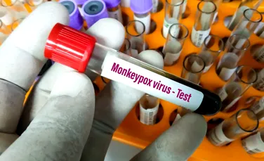 Al doilea vaccin împotriva variolei maimuței, aprobat de OMS