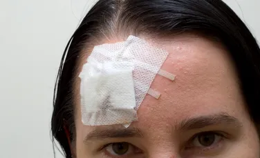 Ai grijă de capul tău: loviturile pot avea avea urmări grave mulţi ani mai târziu