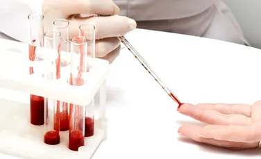 Un simplu test de sânge ar putea diagnostica 5 tipuri de cancer. ”Nimeni  nu a mai dormit în noaptea de după această descoperire” – VIDEO
