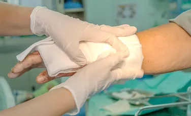 Un dispozitiv bazat pe Inteligență Artificială vindecă rănile cu 25% mai rapid decât tratamentul obișnuit