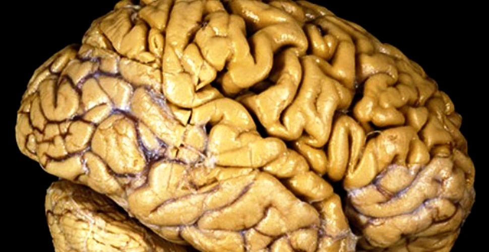 Daca suntem atat de inteligenti, de ce ni se micsoreaza creierele?