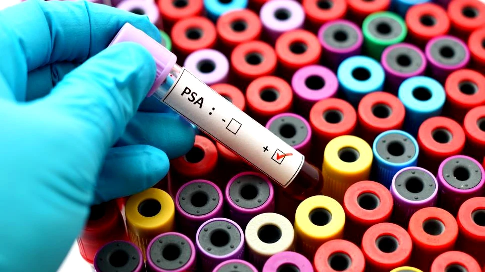 Un nou test poate salva nenumărate vieţi prin determinarea riscului de apariţie a unuia dintre cele mai devastatoare tipuri de cancer