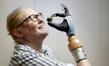 O mână bionică revoluționară a fuzionat cu oasele, mușchii și nervii unei femei