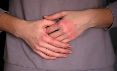 Inflamația din organism ar putea influența sănătatea mintală?