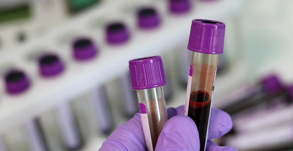 Un test de sânge poate evalua eficiența imunoterapiei