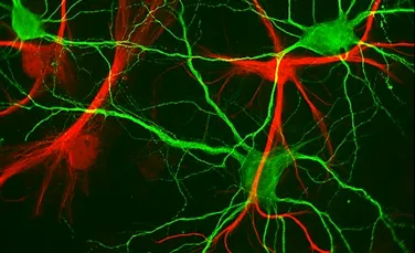 Neuronii nu sunt lasati sa someze – stire in exclusivitate