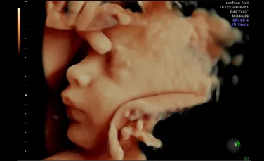 Zâmbetele şi mişcările viitorului bebeluş pot fi urmărite în 3D graţie unei tehnologii inovatoare (FOTO/VIDEO)