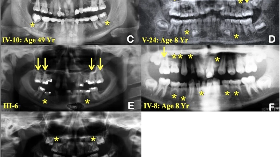 A fost descoperită cauza pentru o mutație genetică misterioasă