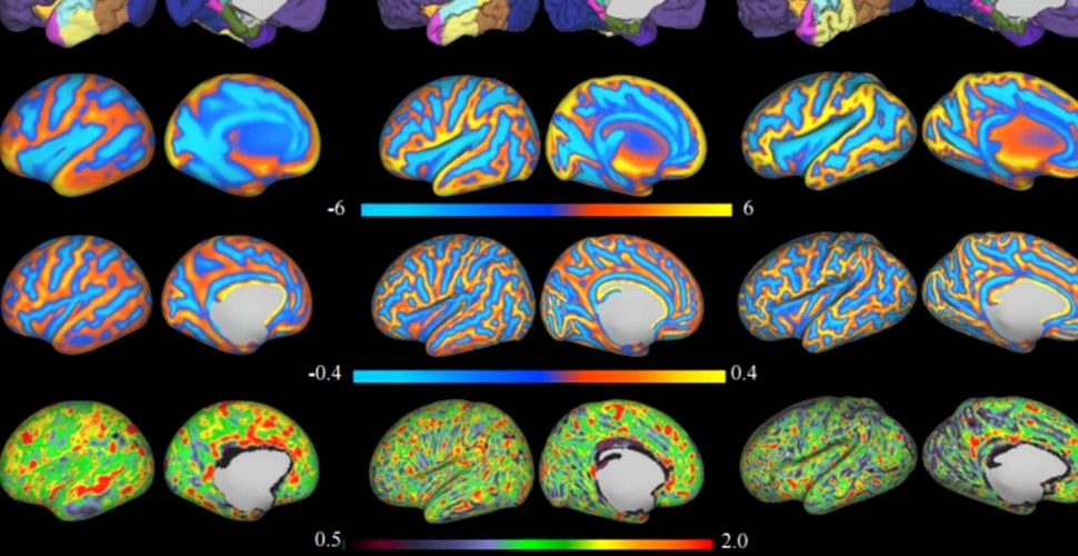 Cum evoluează creierul nou-născuţilor? Cercetătorii au scanat creierul bebeluşilor la câteva zile de la naştere