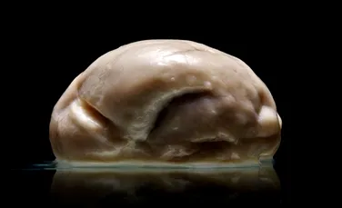 Un creier fără circumvoluţiuni a fost descoperit într-un depozit abandonat. Este un caz unic (FOTO)