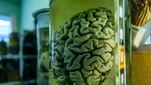 Universitatea daneză care găzduiește cea mai mare colecție de creieri umani din lume
