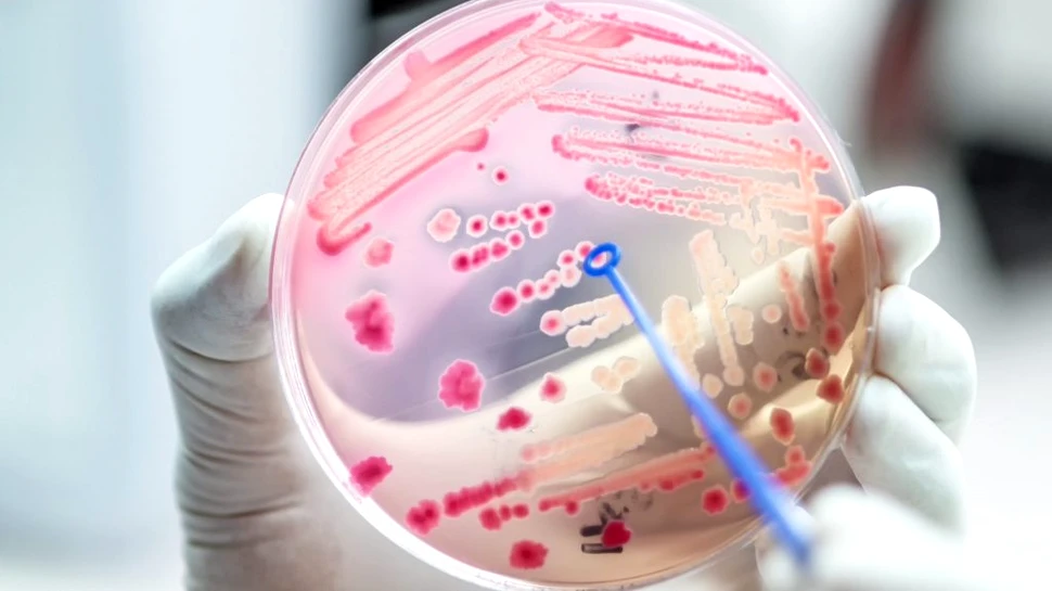 Rezistența la antibiotice ucide acum mai mulți oameni decât HIV/SIDA sau malaria