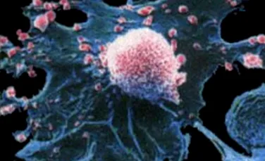 Cancerul ar putea fi vindecat cu nanomagneti