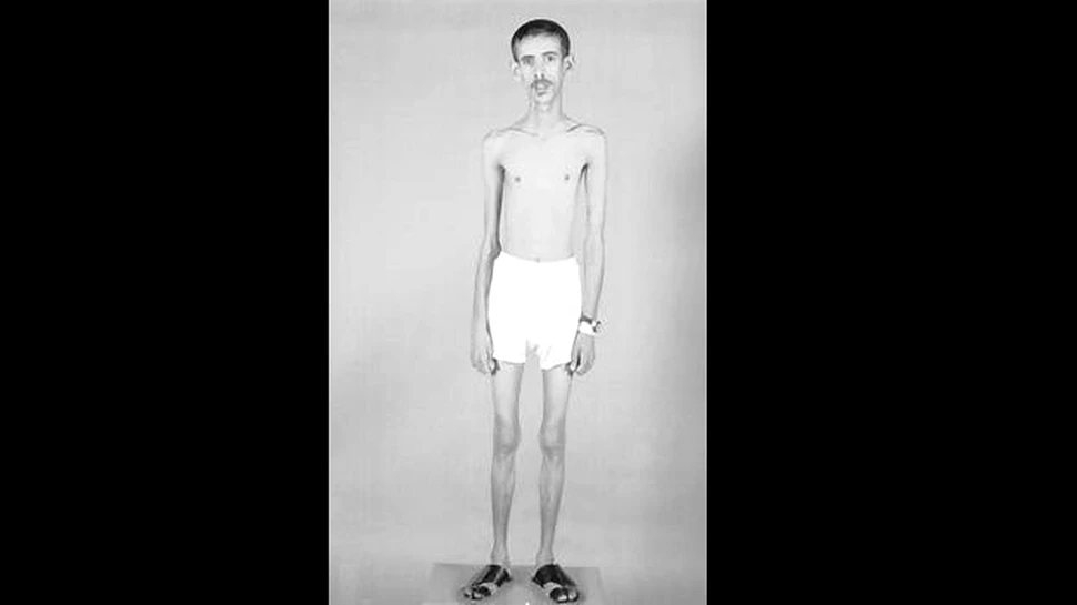 Descoperire în premieră: genele care te împiedică să te îngraşi