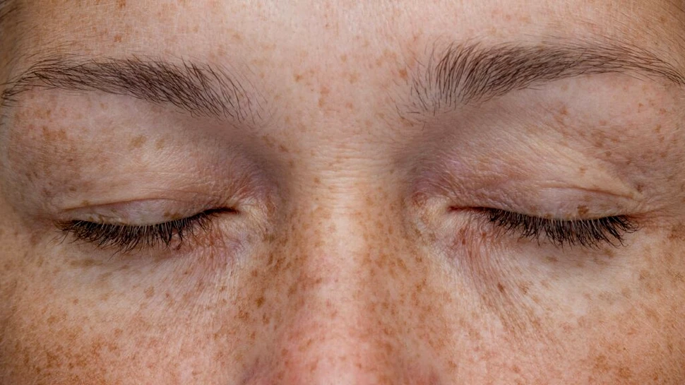 Paradoxul pistruilor: De la „semne ale diavolului” la cel mai dorit trend de beauty. Ce spune știința despre petele care fascinează lumea?