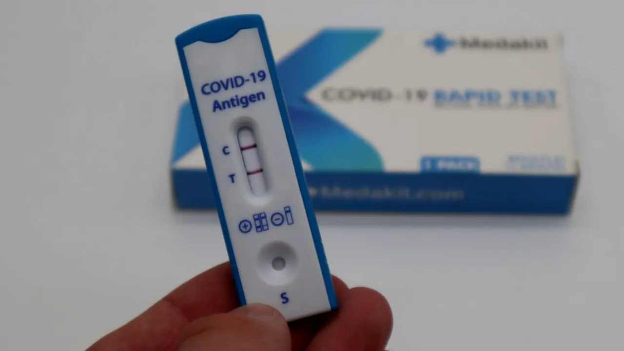 test-covid-coronavirus-antigen-unsplash_descopera 