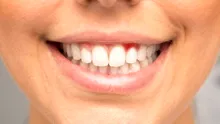 Sângerarea gingiilor ar putea fi un semn precoce al unei afecțiuni mult mai grave
