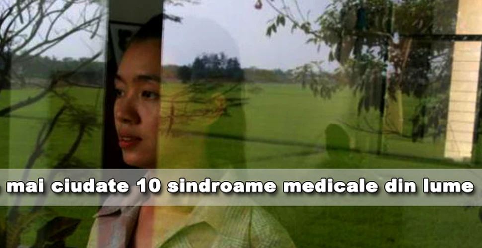 Cele mai ciudate 10 sindroame medicale