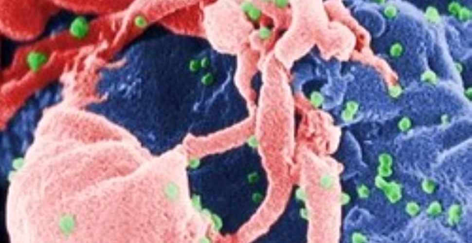 Un mix de trei anticorpi neutralizeaza virusul HIV