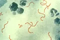 Cercetătorii au descoperit „trucul” prin care bacteriile evită antibioticele