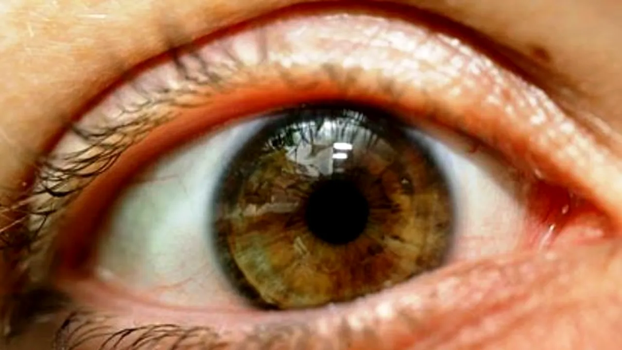 1-iris 