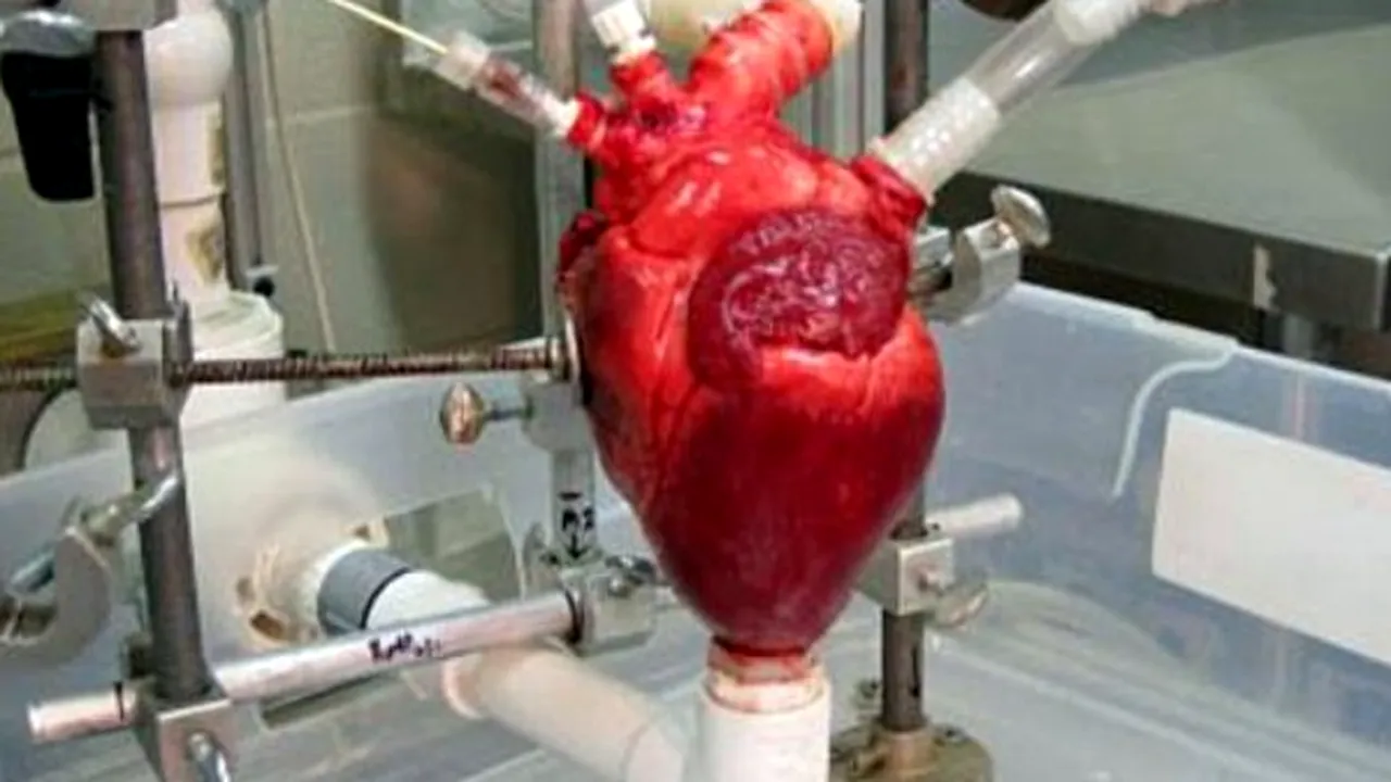 1-sistem-cardiac-dinamic 