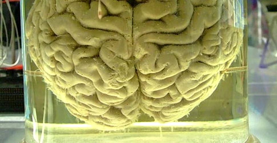 Cât de etică este crearea ”mini-creierelor” umane în laborator