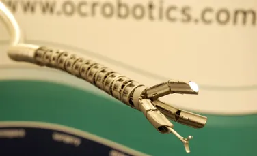Roboţii se alătură medicilor în lupta anticancer