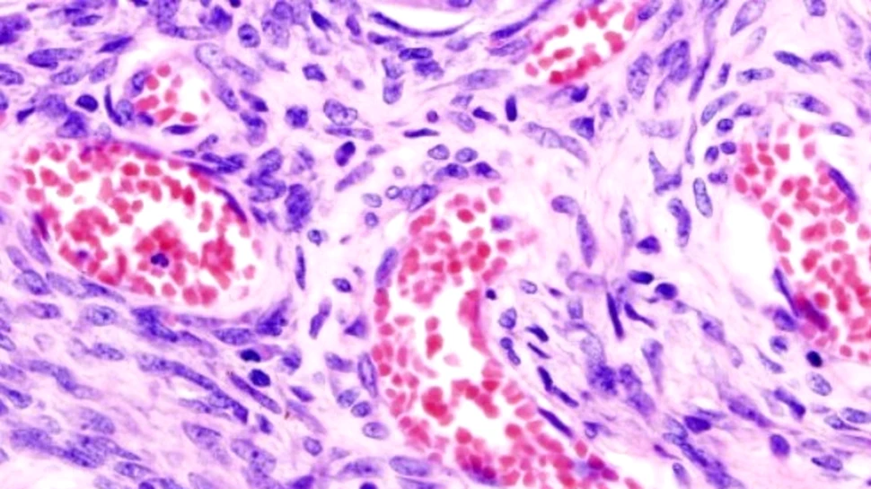 Pentru a supravietui cancerului, traieste cu el!