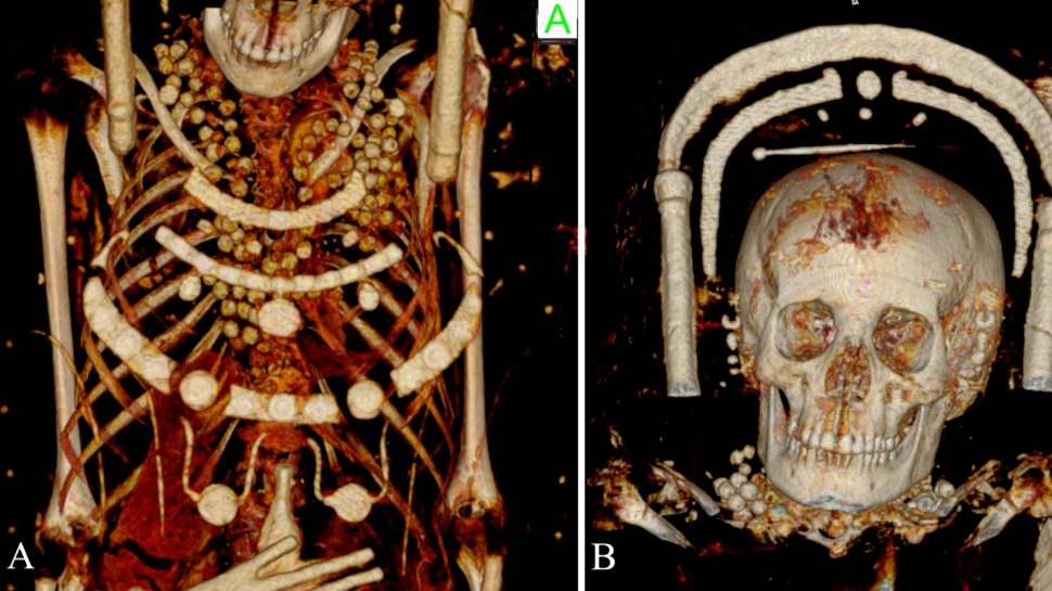 Arheologii au reușit, în sfârșit, să vadă ce ascund la interior mai multe mumii descoperite în 1615