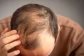 Leacul pentru căderea părului, deja cunoscut din medicina chineză antică?