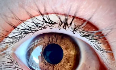 Cum ne afectează boala Alzheimer ochii?