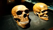 O anomalie cerebrală la oamenii moderni își are originea în ADN-ul neanderthalian străvechi