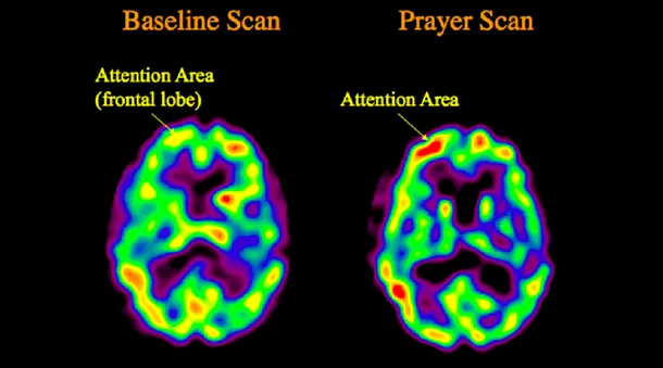 Creierul unei persoane în timp ce se roagă (dreapta) şi în stare de relaxare (stânga)