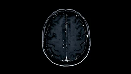 Un test de sânge îi poate ajuta pe medici să identifice mai bine severitatea leziunilor cerebrale
