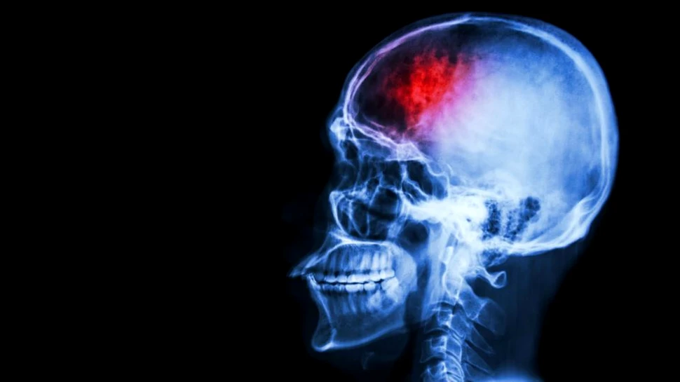 Neurosavanţii încearcă să modifice circuitele creierului pentru a eradica durerea