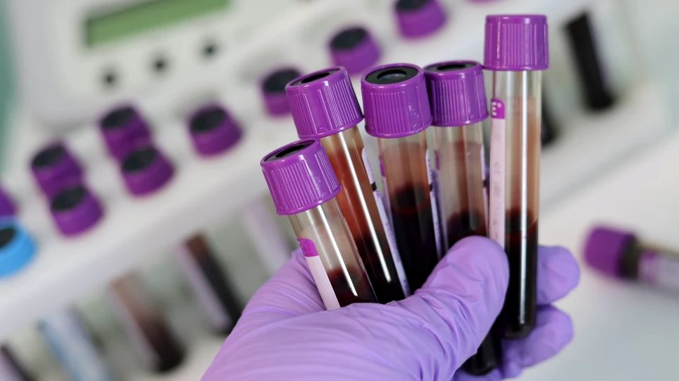 Vector, un laborator din Rusia care deţine mostre de virusuri precum Ebola, HIV şi variolă, zguduit de o explozie. Anunţul autorităţilor