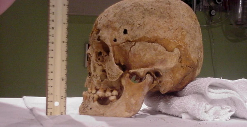 Operatie pe creier facuta in Apuseni acum 4500 de ani!