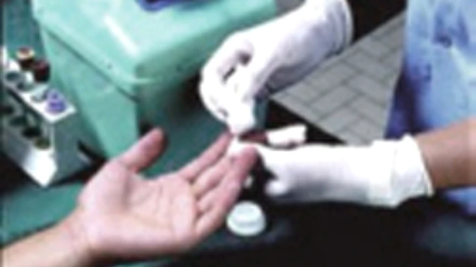 Un stent pentru tratamentul diabetului